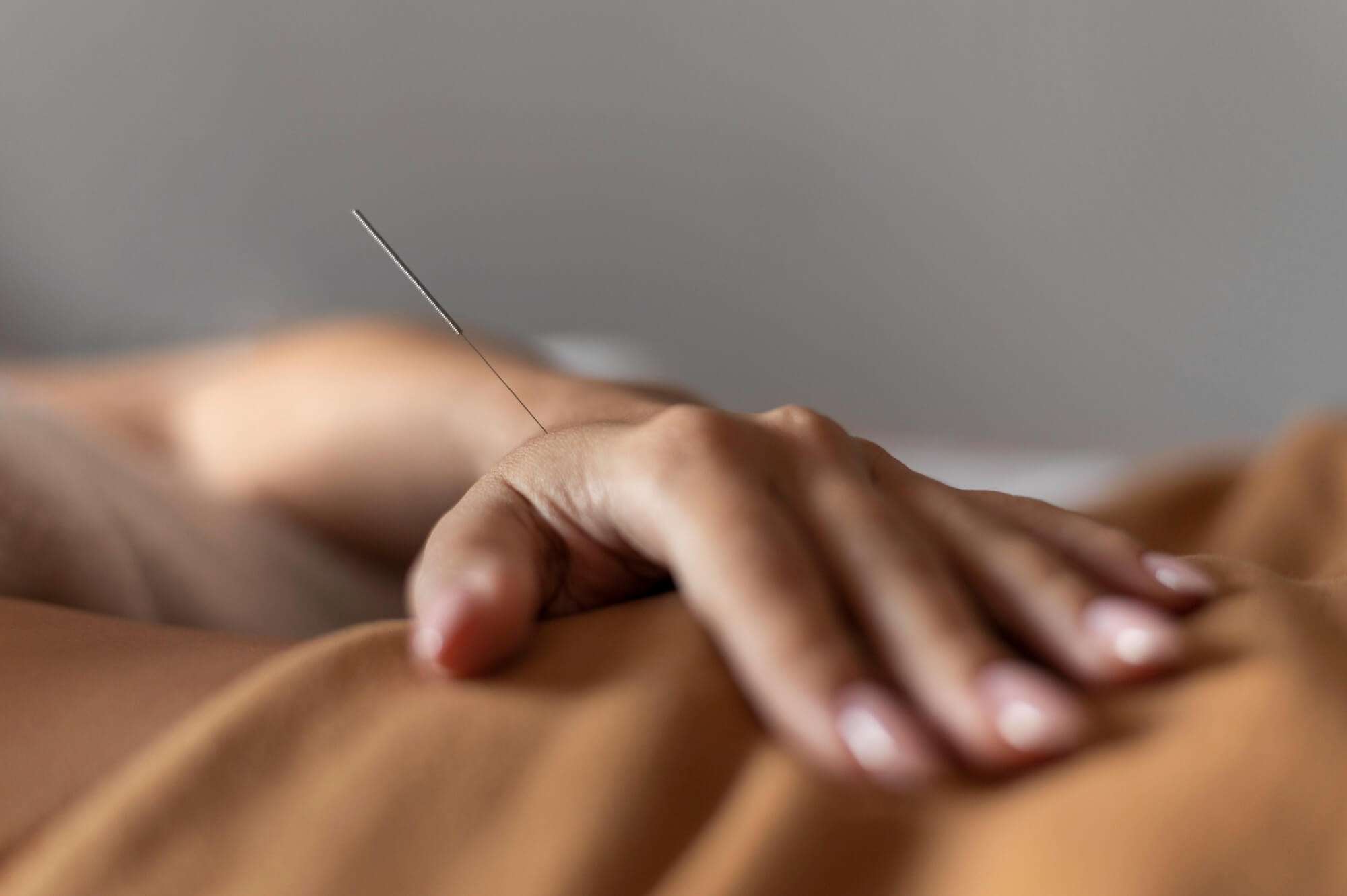 acupuncture grossesse
